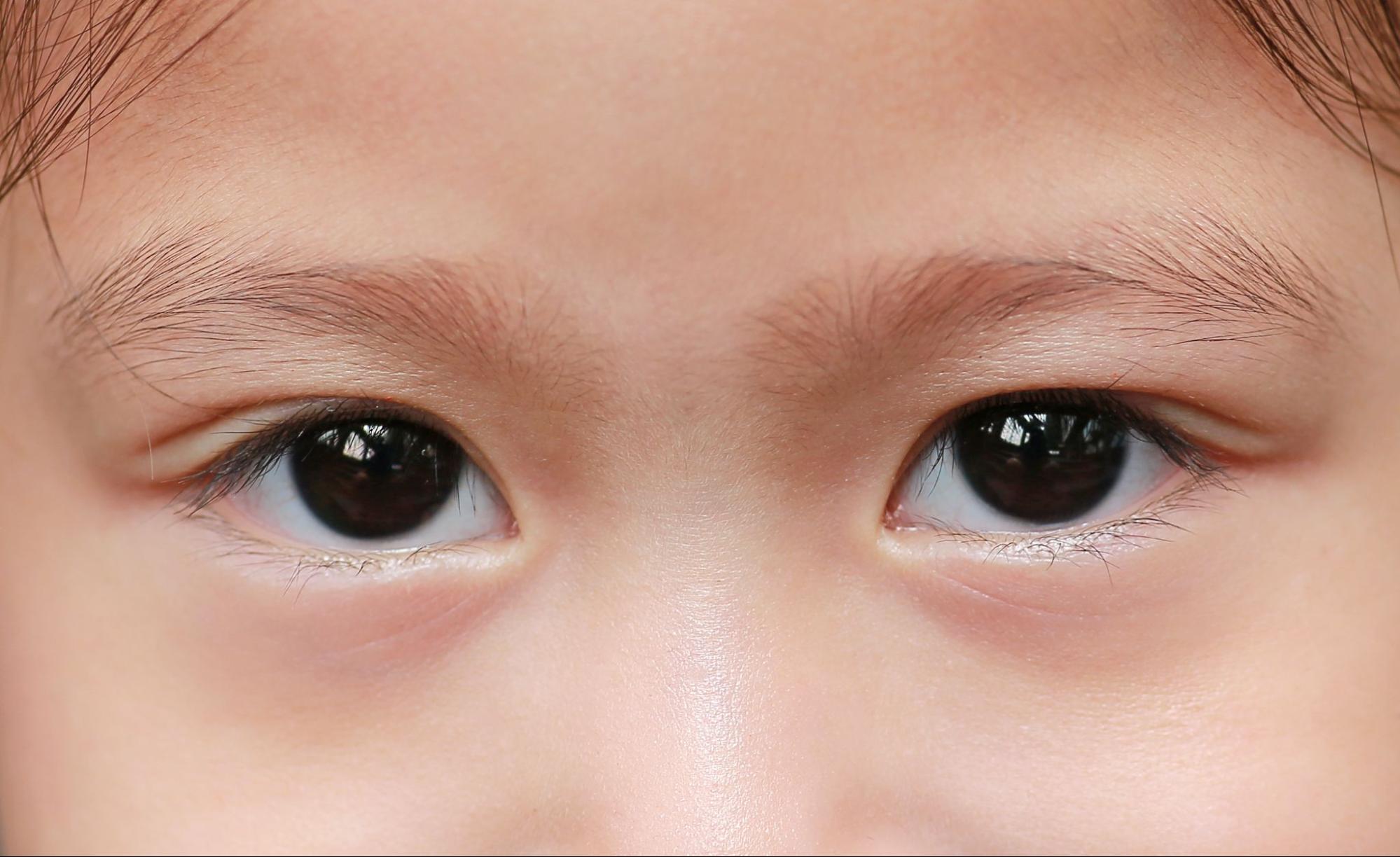 子どもの目元
